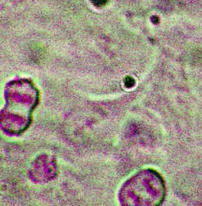 A549 Adenocarcinoma Cells