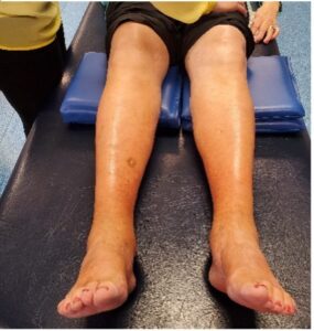 Picture of human legs