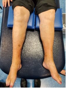 Picture of human legs